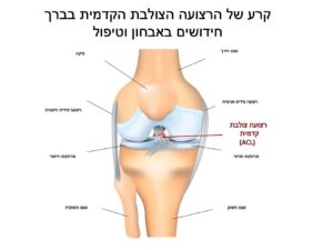 רצועה צולבת קדמית