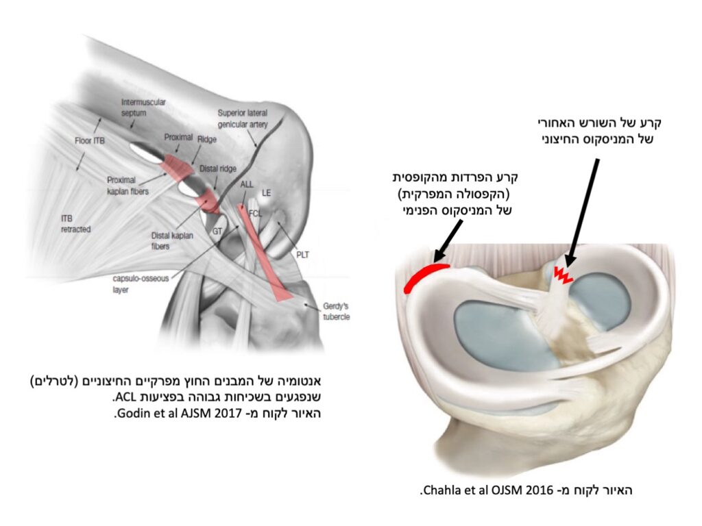 קרע מניסקוס