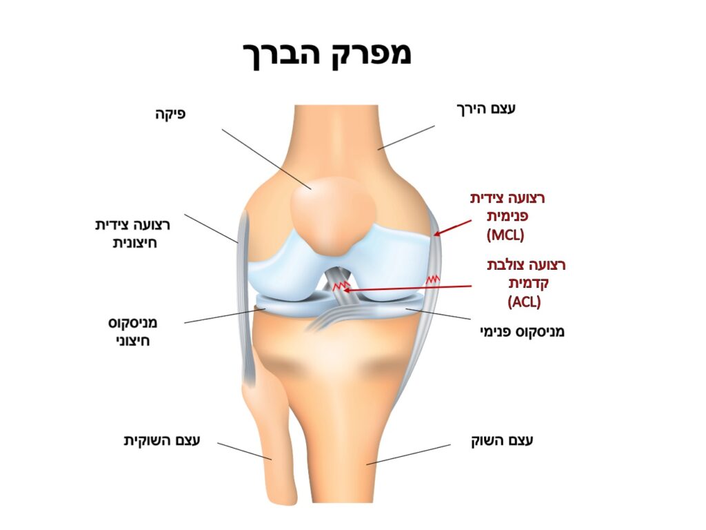 אנטומיה של מפרק הברך, פגיעת רצועה צולבת קדמית ורצועה צידית פנימית