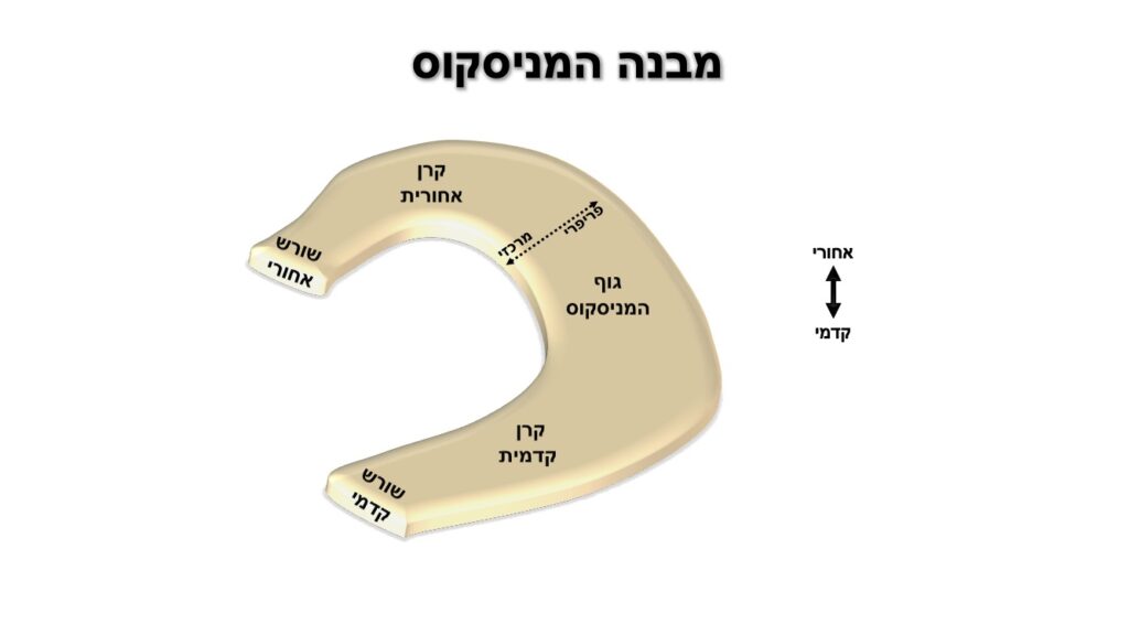 מניסקוס