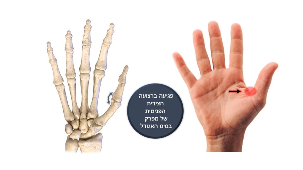 skier thumb
