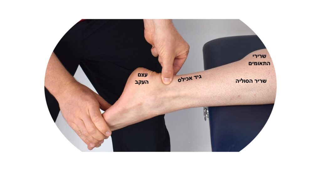 טנדינוזיס של גיד אכילס