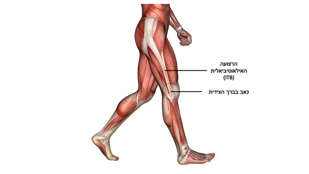 כאב ברך
